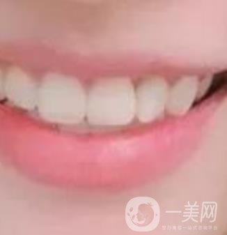 龍崗中心醫(yī)院整牙多少錢？價格表2020收費明細(xì)公開一覽