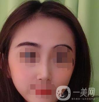 南昌二附院整形美容科價格表及祛痣日志公開，速覽