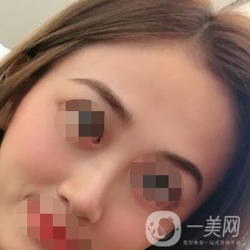 南昌二附院整形美容科價格表及祛痣日志公開，速覽