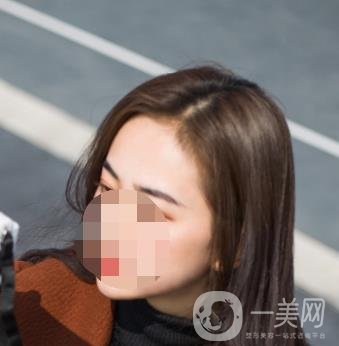 南昌二附院整形美容科價格表及祛痣日志公開，速覽