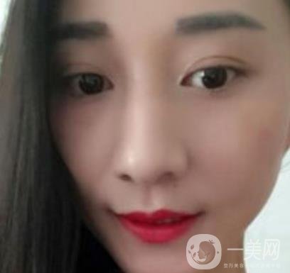 安醫(yī)一附院整形外科價(jià)格表2020版，還有激光祛斑案例