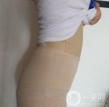 襄陽市第一人民醫(yī)院整形美容科吸脂瘦肚子多少錢？價(jià)格表整形日記一覽