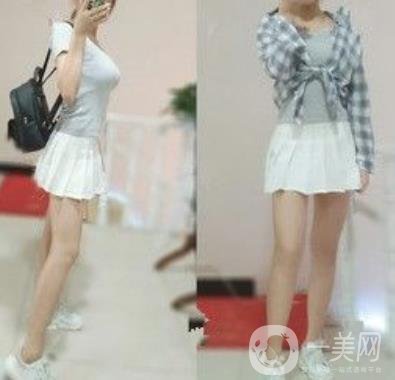 襄陽市第一人民醫(yī)院整形美容科吸脂瘦肚子多少錢？價(jià)格表整形日記一覽