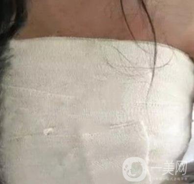 廣州南方醫(yī)院美容科怎么樣?附2020全新價格表及隆胸案例