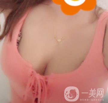 廣州南方醫(yī)院美容科怎么樣?附2020全新價格表及隆胸案例