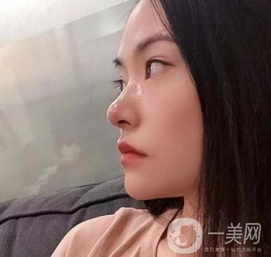 廣州南方醫(yī)院去眼袋費用多少?2020整形價格表一覽