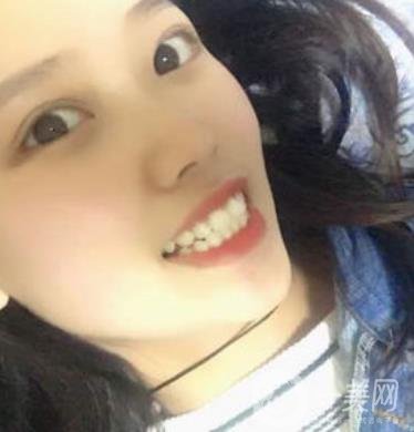 廣州曙光醫(yī)院整牙