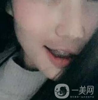 桂林美奧口腔醫(yī)院價(jià)格表全新版，附牙齒矯正案例