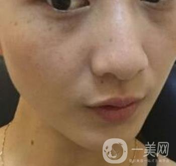 青醫(yī)附院整形美容科價(jià)格表及祛斑案例公布，速覽