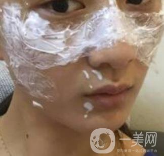 青醫(yī)附院整形美容科價(jià)格表及祛斑案例公布，速覽