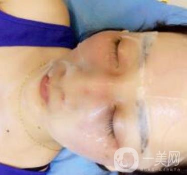 青醫(yī)附院整形美容科價(jià)格表及祛斑案例公布，速覽