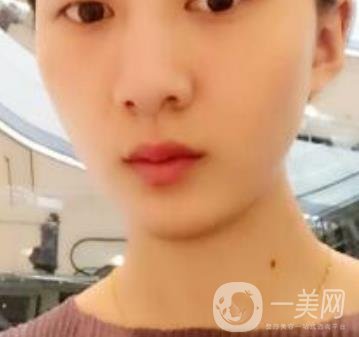 青醫(yī)附院整形美容科價(jià)格表及祛斑案例公布，速覽