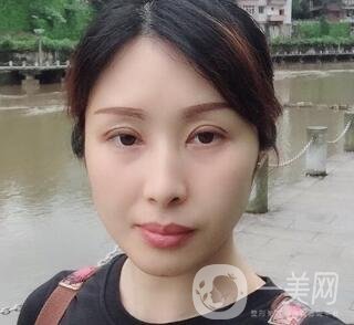 沈陽(yáng)軍區(qū)總醫(yī)院整形外科價(jià)格表，附雙眼皮真實(shí)案例