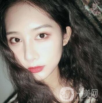 南通市第三人民醫(yī)院整形科價格表+隆鼻整形案例一覽