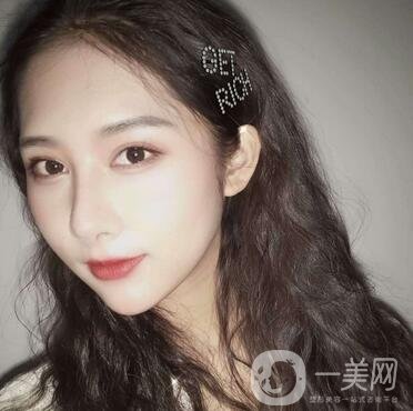 南通市第三人民醫(yī)院整形科價格表+隆鼻整形案例一覽