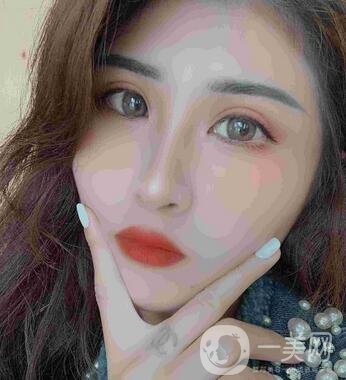 山西省整形外科醫(yī)院割雙眼皮怎么樣?案例價(jià)格表來(lái)襲