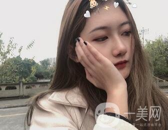 重慶新橋醫(yī)院整形科價格表，隆鼻案例分享