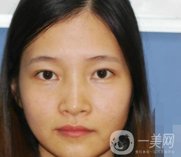 北京朝陽醫(yī)院整形中心紋眉*果怎么樣？價格價目表詳情一覽