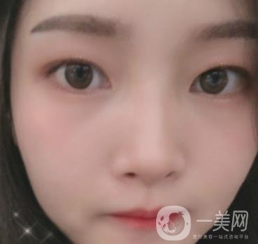 北京朝陽醫(yī)院整形中心紋眉*果怎么樣？價格價目表詳情一覽