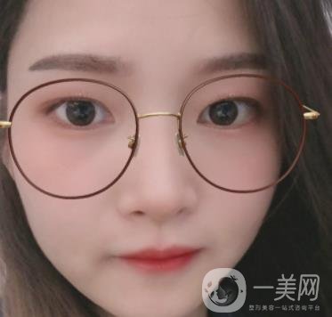 北京朝陽醫(yī)院整形中心紋眉*果怎么樣？價格價目表詳情一覽