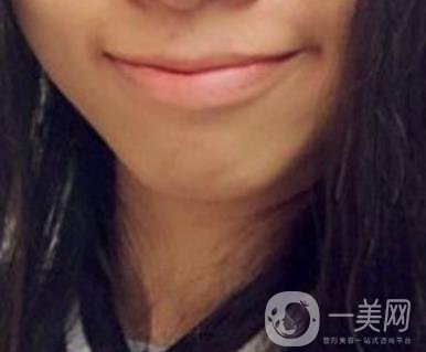 復(fù)旦大學(xué)附屬兒科醫(yī)院口腔科做牙齒矯正多少錢(qián)？?jī)r(jià)格表明細(xì)一覽