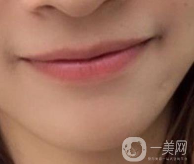 復(fù)旦大學(xué)附屬兒科醫(yī)院口腔科做牙齒矯正多少錢(qián)？?jī)r(jià)格表明細(xì)一覽