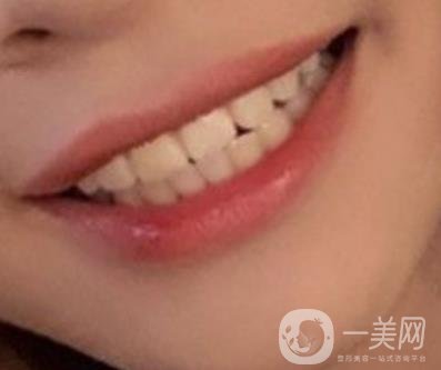 復(fù)旦大學(xué)附屬兒科醫(yī)院口腔科做牙齒矯正多少錢(qián)？?jī)r(jià)格表明細(xì)一覽