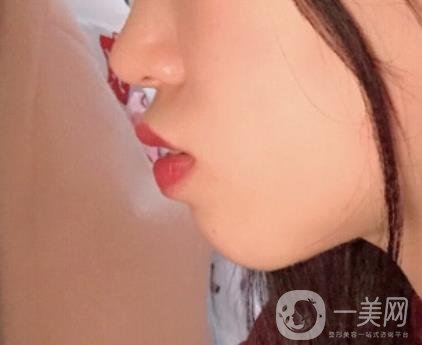 復(fù)旦大學(xué)附屬兒科醫(yī)院口腔科做牙齒矯正多少錢(qián)？?jī)r(jià)格表明細(xì)一覽