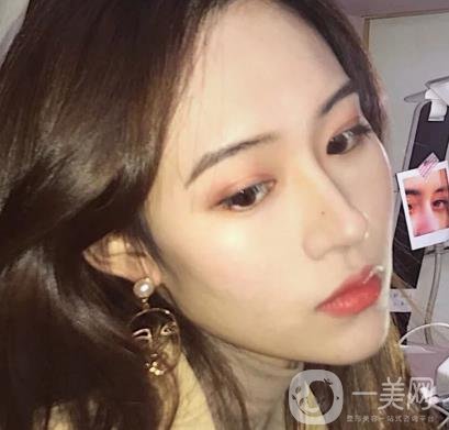 西京醫(yī)院整眼袋