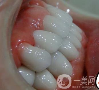 杭州格萊美醫(yī)院整牙