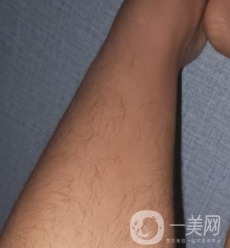 哈醫(yī)大四院整形美容科價(jià)格表鉅惠來(lái)襲，附冰點(diǎn)脫毛案例