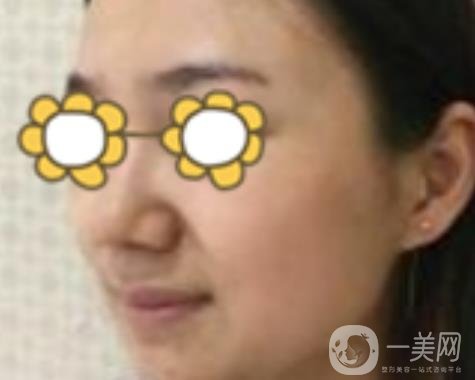 阜陽市人民醫(yī)院整形美容科價格表2020版，附*案例