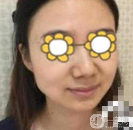 阜陽市人民醫(yī)院整形美容科價格表2020版，附*案例