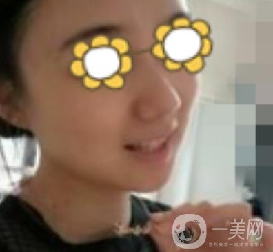 阜陽市人民醫(yī)院整形美容科價格表2020版，附*案例