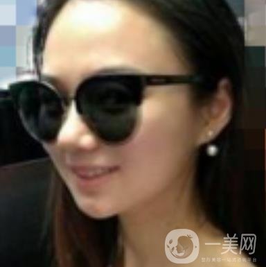 阜陽市人民醫(yī)院整形美容科價格表2020版，附*案例