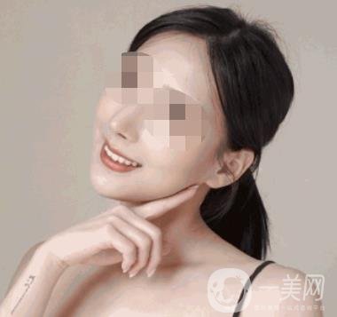 河南省人民醫(yī)院整形美容科價(jià)格表公布，附除腋臭案例