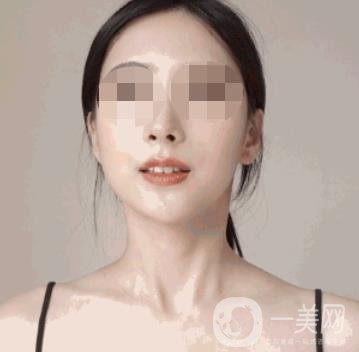 河南省人民醫(yī)院整形美容科價(jià)格表公布，附除腋臭案例