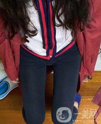 邢臺(tái)人民醫(yī)院整形美容科價(jià)格表，附大腿吸脂案例