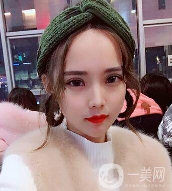 湖南第一醫(yī)院整形科價(jià)格表，附雙眼皮案例