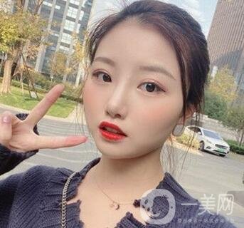 青島青醫(yī)附院整形價格表，還有雙眼皮實例