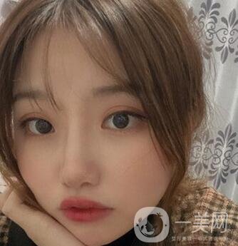 青島青醫(yī)附院整形價格表，還有雙眼皮實例