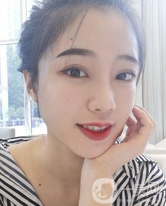 哈爾濱醫(yī)大二院美容科隆鼻*果咋樣?附價格表一覽