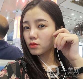 哈爾濱醫(yī)大二院美容科隆鼻*果咋樣?附價格表一覽