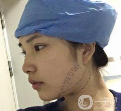 聊城市人民醫(yī)院整形科價(jià)格表及*案例一覽