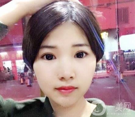 聊城市人民醫(yī)院整形科價(jià)格表及*案例一覽