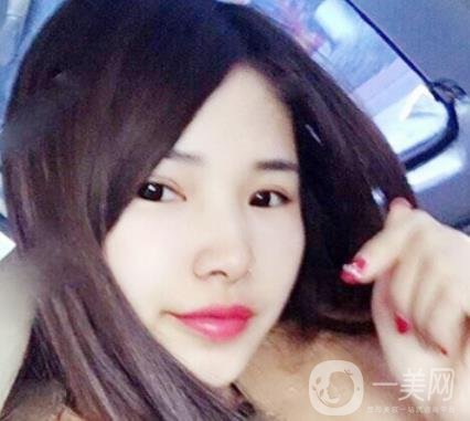 聊城市人民醫(yī)院整形科價(jià)格表及*案例一覽