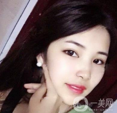 聊城市人民醫(yī)院整形科價(jià)格表及*案例一覽