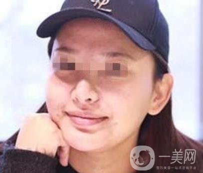 西南醫(yī)院*多少錢?附整形價(jià)格表及真實(shí)案例