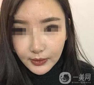 西南醫(yī)院*多少錢?附整形價(jià)格表及真實(shí)案例