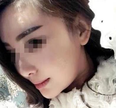 西南醫(yī)院*多少錢?附整形價(jià)格表及真實(shí)案例